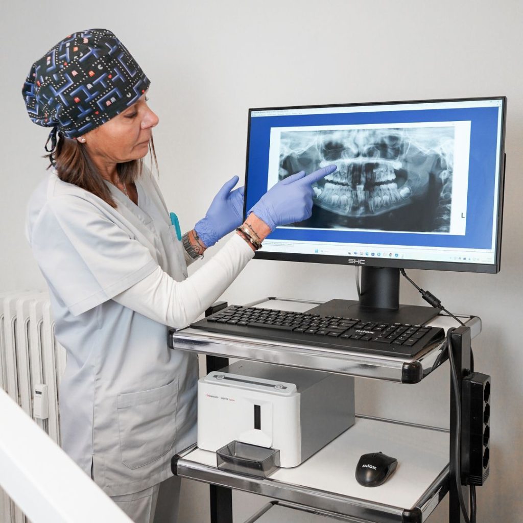 Home 29 ENDODONZIA - devitalizzazione a Milano