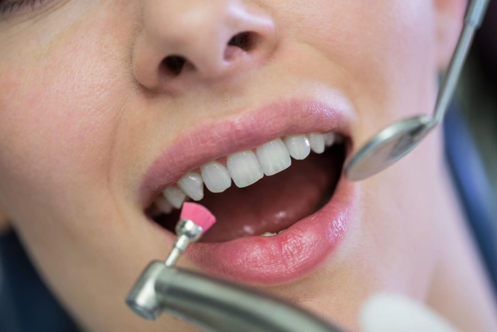 Come funziona la pulizia dei denti: guida completa del dentista 1 come funziona la pulizia dei denti