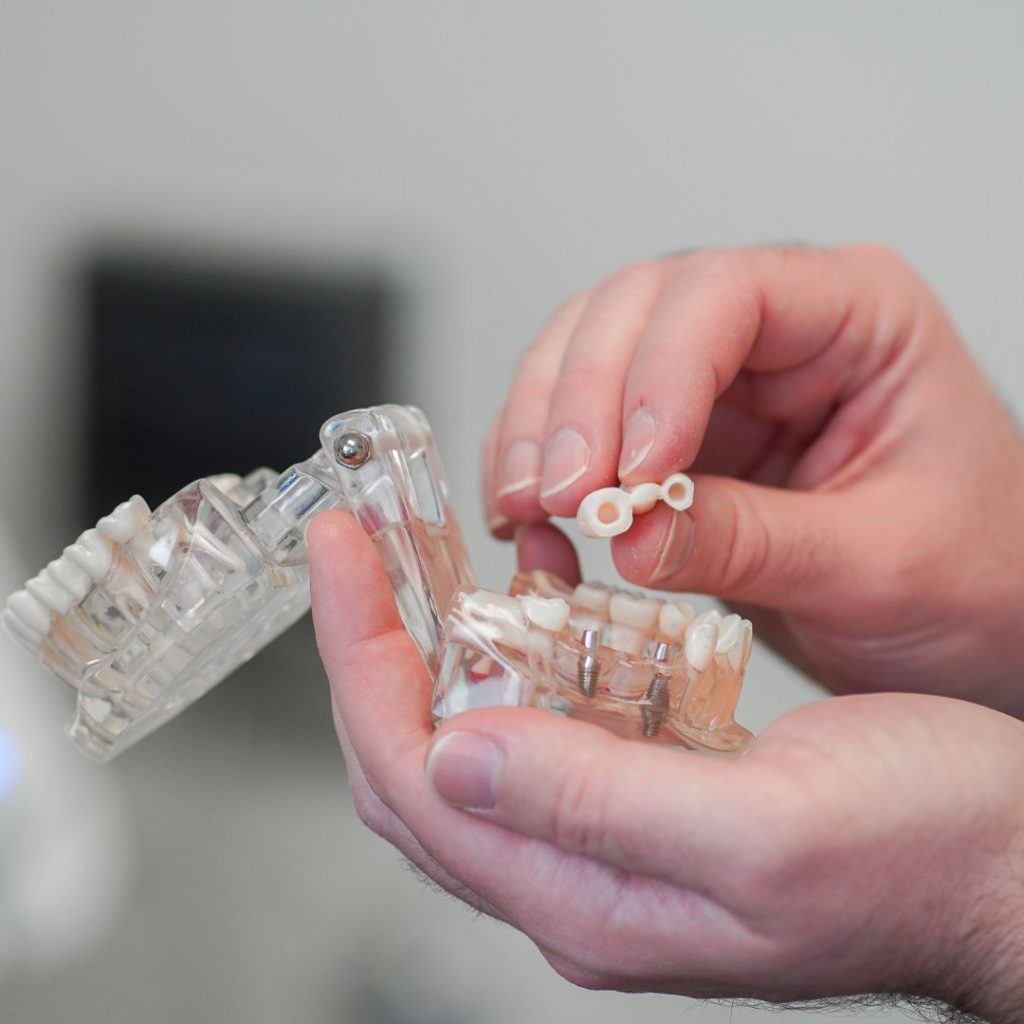 Home 26 PROTESI FISSA E MOBILE - dentiera a Milano